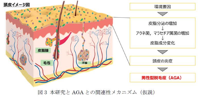 j^EяǁuAGAv҂̓ Sx̍玉igOZhjƂ𔭌