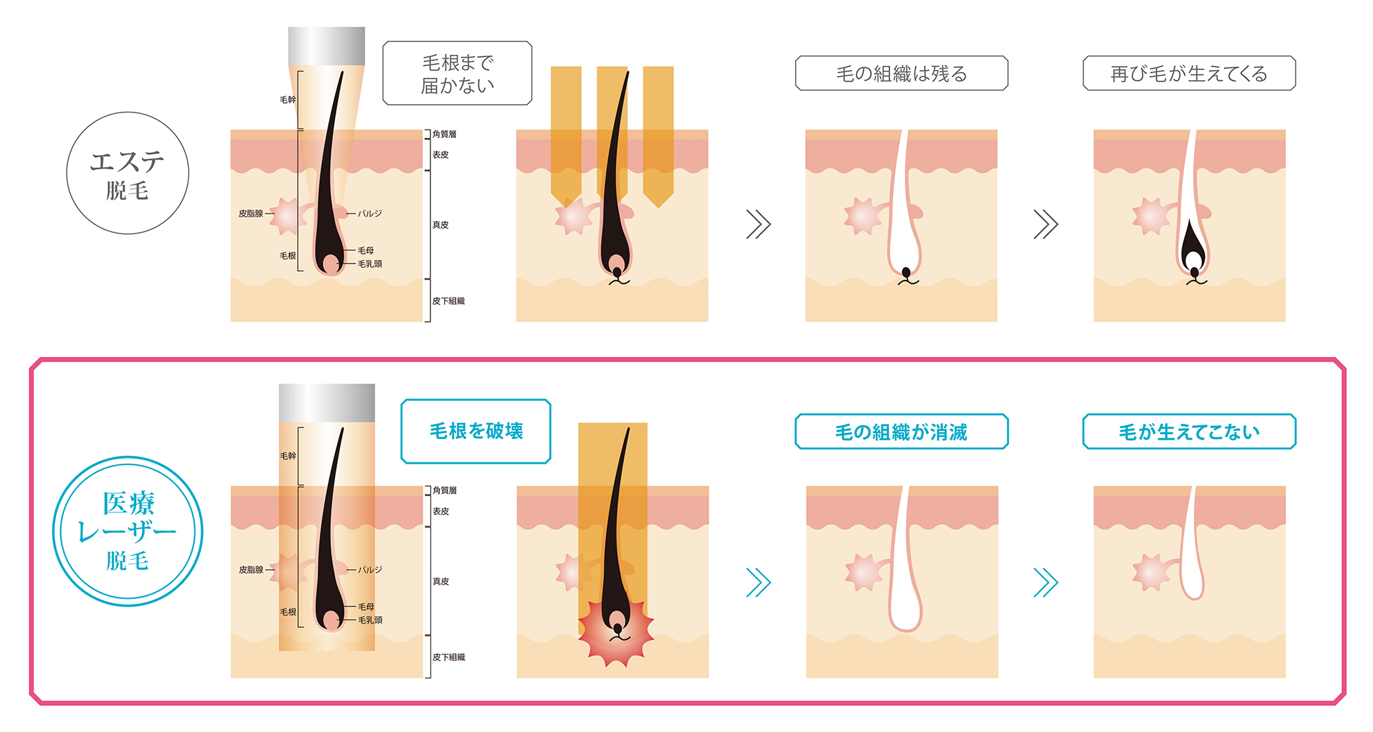 OȐオÒEѐNjbNwMEDICAL EPILATION CLINICS֋@xLbYÒEт{iIɃX^[gI