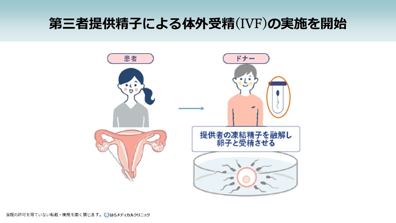 qǂ̏om錠ۏႵOҒ񋟐qɂ̊O(IVF)̎{͂烁fBJNjbNJn