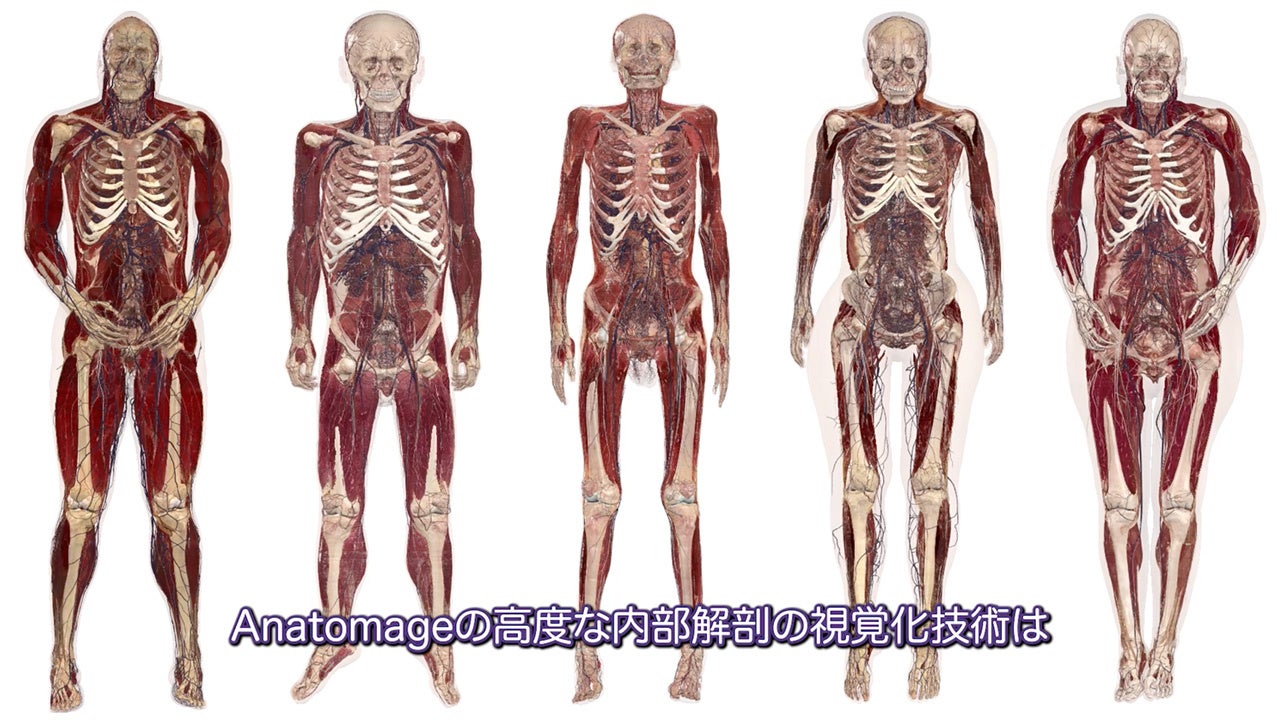 Anatomage JapanAAnatomage Table Vo[W Table11[X