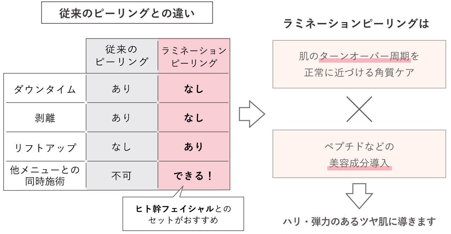 yIztFCVj[u~l[Vs[OvVo@ނȂE_E^CȂ̓甧ĂŐ[s[O