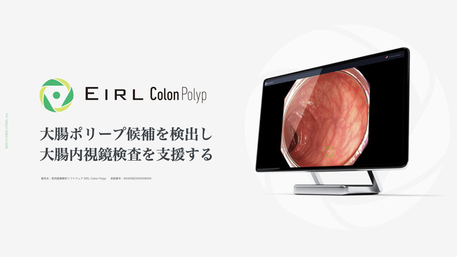 咰|[voA咰xuEIRL Colon Polypv V