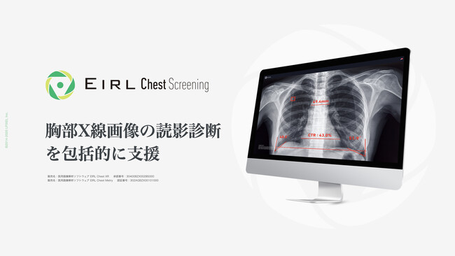 X摜̓ǉeffxEIRL Chest Screening̐Vf𔭔AoُAë̑Ώۏg