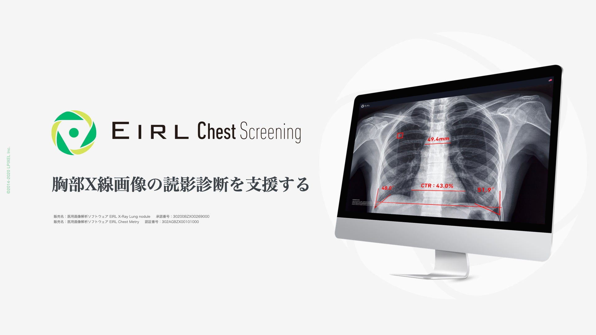 X摜̓ǉeffxEIRL Chest ScreeningAxD^ٓxD̑IłVf𔭔