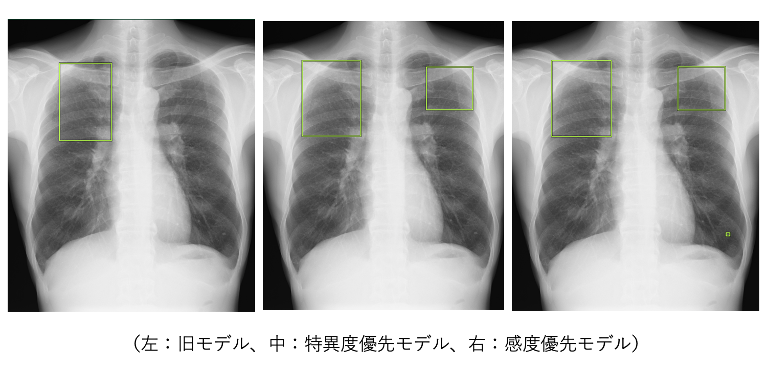 X摜̓ǉeffxEIRL Chest ScreeningAxD^ٓxD̑IłVf𔭔